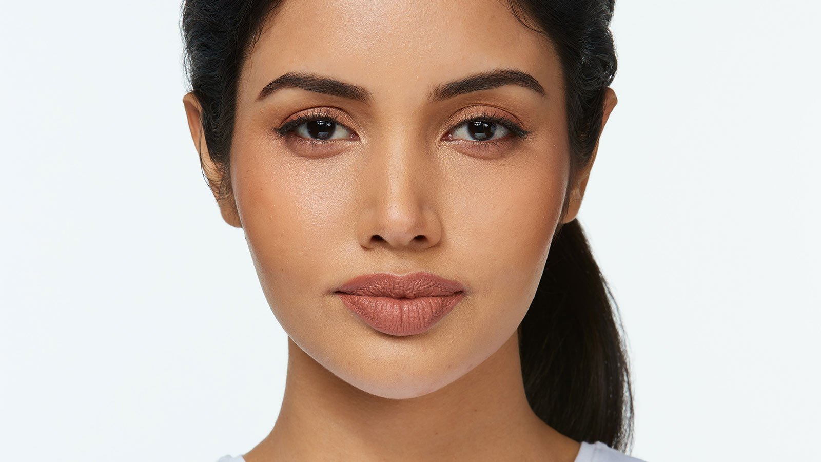 vitiligo adalah